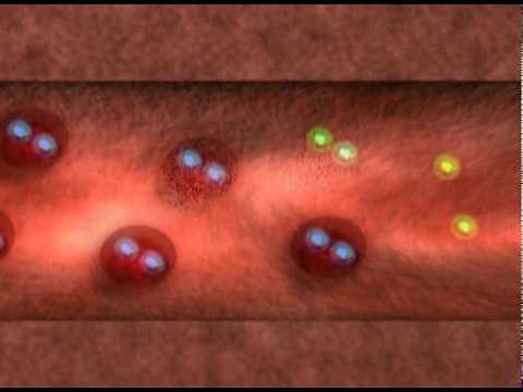 Recognizing and Treating Jaundice