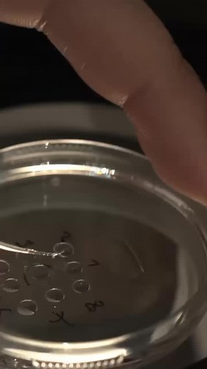 Let’s take you on a journey through ICSI (Intra-Cytoplasmic Sperm Injection) — a technique through which we can help achieve the dream of motherhood Through this process, we can also determine the baby’s gender and study genetic diseases before implantation (PGT-A). #IVF #CMF #Infertility #reproduction #babies #lebanon #pregnancyafter40 #pregnancy #assistedreproductivetechnology #IVFprogram #IVFprogramannouncement #successtory | Dr.Patrick Zaarour