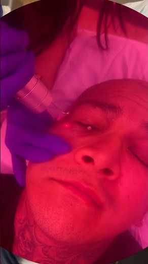 Eye Safety with Lasers- Derm Explains ⚠️