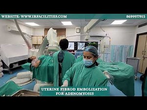 Uterine Fibroid Embolization for Adenomyosis | Dr. Sandeep Sharma | IRFACILITIES
