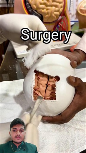 brain surgery fact #skull #brainsurgery #operations #doctor
