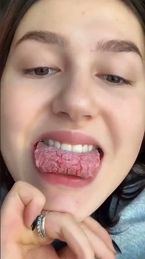 🔥舌がヒリヒリ激痛！辛い食べ物後の秘密の対処法がヤバい😱