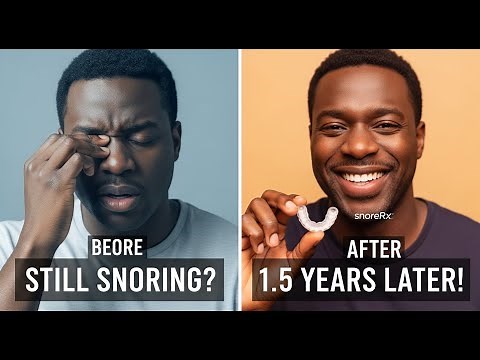 SnoreRx Plus Review: 1.5 Years Later (The Brutal Truth About My Snoring & Sleep Apnea)