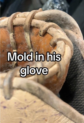 Mold Found in Baseball Glove