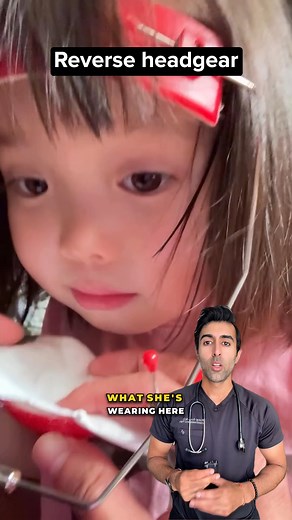 You’ve seen braces, but have you seen this? Reverse headgear is used early to guide jaw growth in kids with underbites, and it can change long-term treatment plans entirely. vc: @baby_lovings Follow @doctorsoood to improve your health IQ and for similar content. #reverseheadgear #classIII #orthodontics #underbite #facemasktherapy #healthtips | Kunal Sood, MD