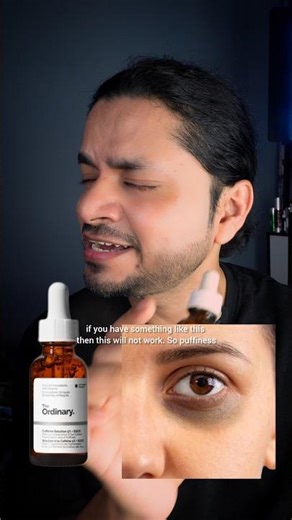 Clayco vs The Ordinary Caffeine Serum ⚡ Which Actually Fixes Dark Circles?