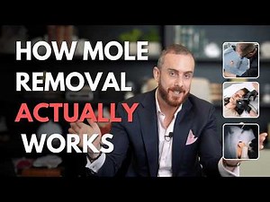 How Mole Removal Actually Works (Explained with Science)