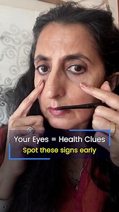 175K views · 782 reactions | How to care for your eyes the right way...