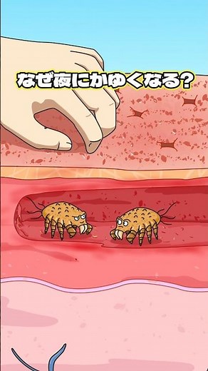 なぜ夜にかゆくなる?