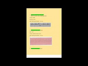 Relias Dysrhythmia Basic A Test Review Solution guide UPDATED 2023 A+ GRADED 100% VERIFIED