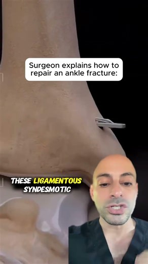 This Is How Surgeons Rebuild A Shattered Ankle