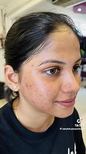 Nose Piercing 😍 | Sri lanka Piercing Stories