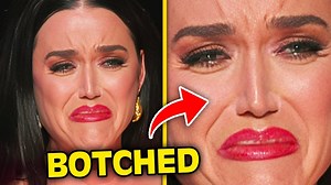 34K views · 281 reactions | Top 10 Celebrities That BROKE The Internet With BOTCHED Plastic Surgery | Inform Overload | Facebook