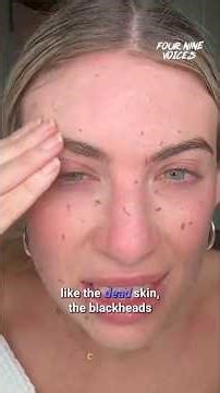 What is coming out of her skin?! 😱 #pores #skincare #beautyhacks