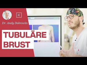 Tubuläre Brust / Schlauchbrust: Was ist das wirklich & ist eine OP möglich? (inkl. 📸 Vorher Nachher)