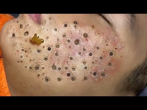 Relax and Satisfying with Loan Nguyen Spa Treatment #1016