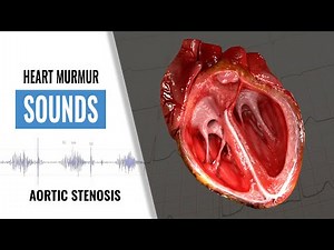 Aortic Stenosis Heart Sound | Heart Murmur | Christina NP