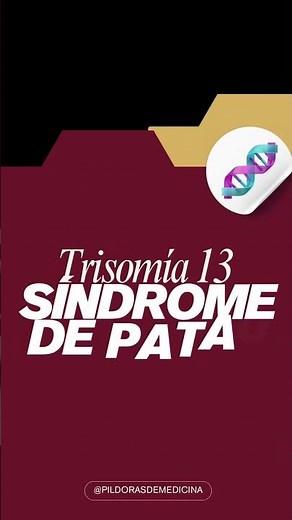 😮 El síndrome GENÉTICO más letal en recién nacidos: Patau #diagnósticomédico #real