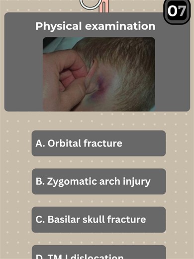 Test Your Medical Knowledge: Can You Name That Sign?