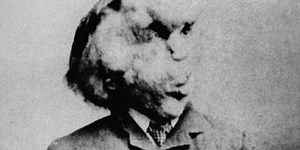 Thousands sign petition to stop ‘freak show’ Elephant Man dissection event