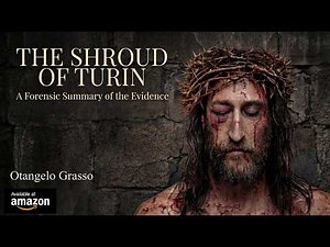 The Shroud of Turin: A Forensic Summary of the Evidence — What Science Can’t Fully Explain