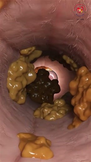 👂 Is Ear Wax Causing Your Hearing Problems? | Safe Removal & What NOT to Do