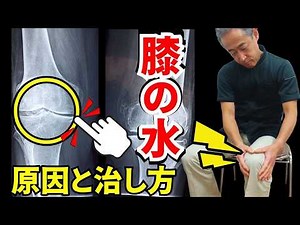 【膝の痛み】 膝の水を自分で抜く方法3つ