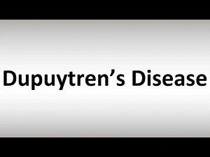 How to Pronounce Dupuytren’s Disease