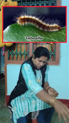 Limi ki Duniya on Instagram: "Burning & itching from caterpillar rash? 😰 Try this hack! 😉 Your Queries: caterpillar rash remedy, caterpillar rash treatment, caterpillar rash home remedy, caterpillar allergy relief, caterpillar rash hack, skin allergy quick fix, itching relief home remedy, rash treatment at home, natural rash remedy, instant rash relief, caterpillar hair allergy remedy #CaterpillarRash #SkinAllergyRelief #HomeRemedy #RashTreatment #InstantRelief #AllergyHack #ItchingRelief #Nat