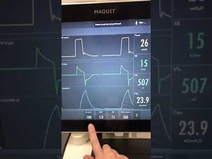 Servo U ventilator video 1