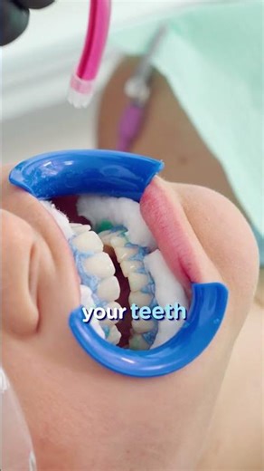 Dentist Reacts to Purple Toothpaste Whitening Trend #shorts