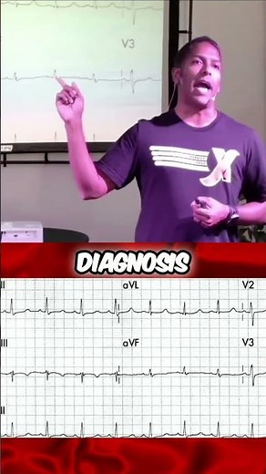Hypocalcemia on the ECG? Anand Swaminathan, MD (@emswami) from ResusX:ReUnion explains. #shorts