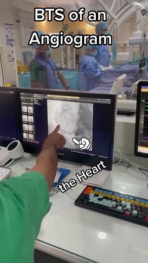 Angiogram Procedure: Behind the Scenes at Durdans Heart Centre