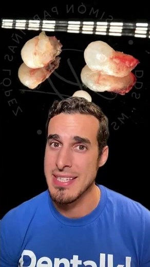 PEARLS growing in her TEETH - Is this possible? - Enamel pearls