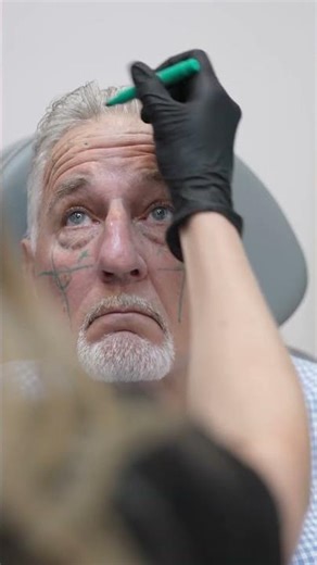 Men’s Full Facial Balancing | Natural Looking Aesthetics for Men at MAC