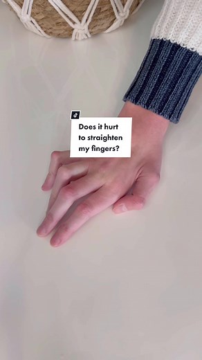 Understanding Ulnar Nerve Damage and Claw Hand Surgery