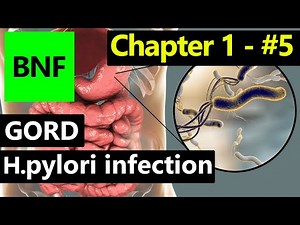 📘 BNF Chapter 1 – Part 5 | 💊 GORD & H. pylori Infection – Easy Explanation, Tests & Treatment Notes