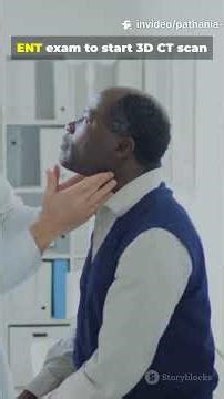 Hidden Cause of Throat Pain Eagle Syndrome treatment by Dr Pathania #styalgia #styloidectomy