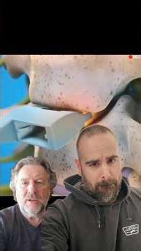 Herniated disc = surgery required? 🤔