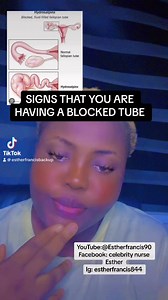 31K views · 454 reactions | HSG( HYSTEROSALPINGOGRAM) CAN DETECT IF YOUR TUBES ARE BLOCKED OR NOT#fertility#pregnancy#celebritynurseestherpage | Celebrity Nurse Esther | Facebook