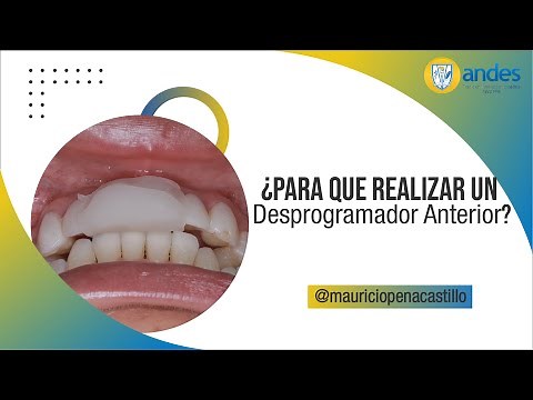 ¿Para que Realizar un Desprogramador Anterior? CONCLUSIÓN OCLUSIÓN