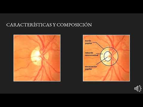 El Punto Ciego del Ojo: Disco óptico o Papila óptica
