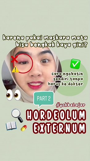 Effective Treatment for Hordeolum Externum Explained by a Doctor