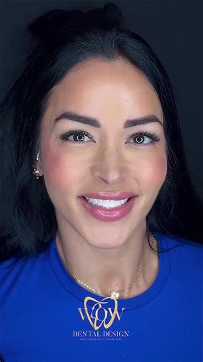 At WOW Dental Design, we don’t just transform smiles… we design confidence. ✨🦷 Every detail matters: precision, aesthetics, and a personalized approach to achieve natural, long-lasting results. Because your smile is part of who you are, and it deserves to be treated like a work of art. 📍 Advanced technology 🤍 Personalized dental design 😁 Results that speak for themselves WOW Dental Design — where smiles are designed with intention.