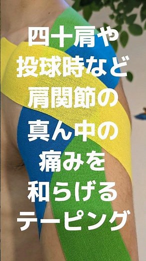 四十肩や野球⚾の投球時など肩関節の真ん中か少し下が痛む時のテーピングの貼り方です✨痛みの出やすい挙上と捻れをサポートします。#四十肩のテーピング#野球肩のテーピング