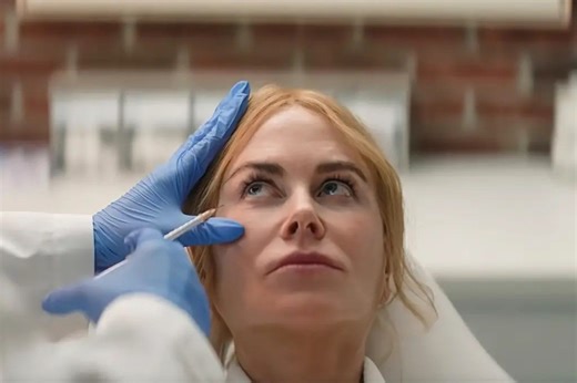 Is Botox ruining cinema?