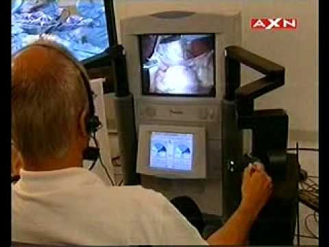 Tele Surgery - "Lindbergh Operation"