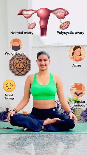 862K views · 18K reactions | 10 Yoga asanas to control PCOD / Hormonal Imbalance ✨ #Pcod #yoga #hormones #moodswings #weightgain #acne #yogagirl #yogapose #asana #health #ﬁtness #womens | Manoyog kendra | Facebook