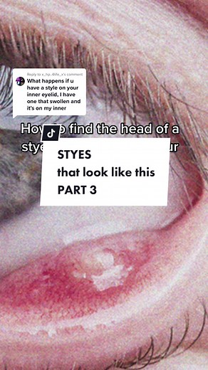 We Love Eyes on TikTok