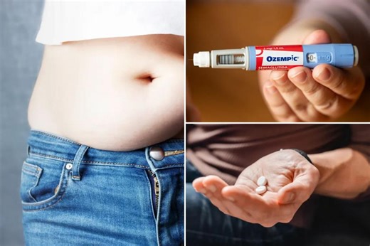 ‘Game changer’ Ozempic-like pill causes 13% weight loss — here’s when it could become available